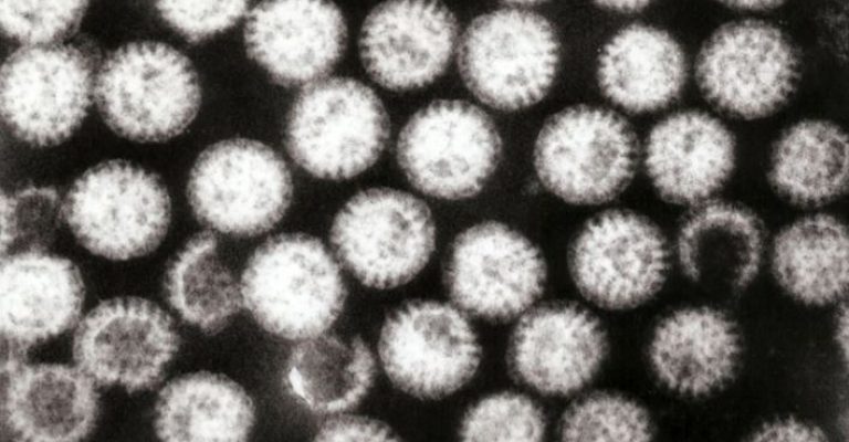 viroza